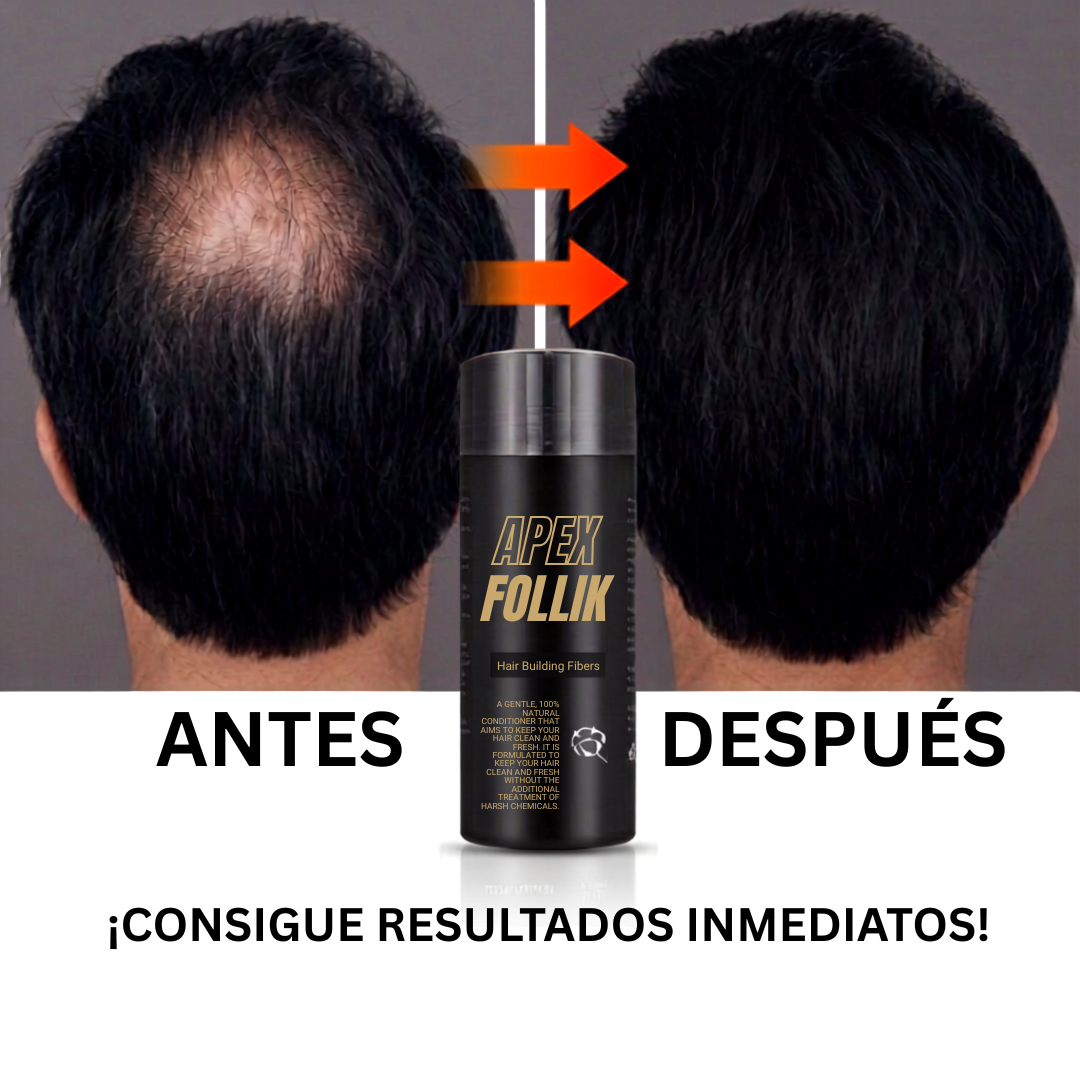 Fibras Capilares Apex Follix™ - Cabello Denso al Instante