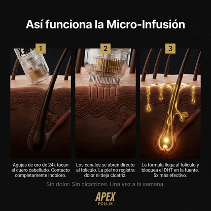 Apex Follix - Sistema de Crecimiento del Cabello y Barba